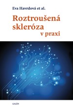 Roztroušená skleróza v praxi