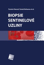 Biopsie sentinelové uzliny