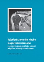 Vyšetření ramenního kloubu magnetickou rezonancí s podrobným popisem nálezů u omezení pohybů u boles